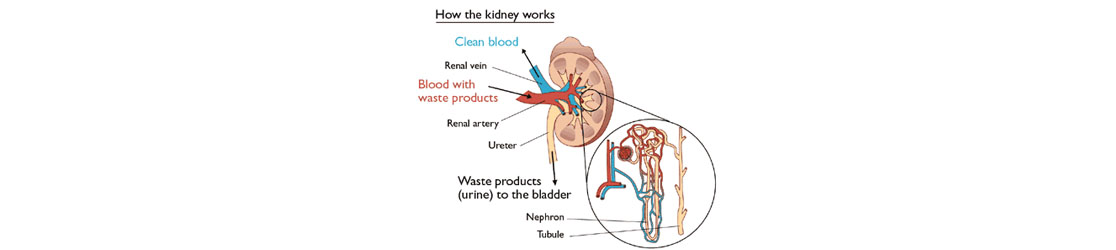 Kidney specialist In India